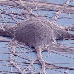 Colorized scanning electron micrograph of a neuron. Thomas Deerinck, UC San Diego National Center for Microscopy and Imaging