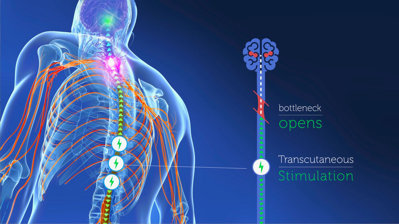 Image of spine showing nerves and where break in spinal injury occurs