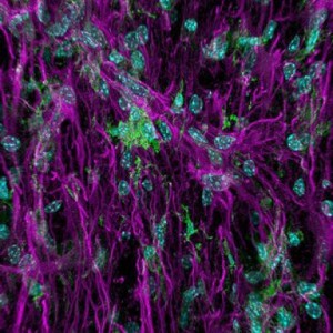 Inflammation after spinal cord injury. Image source: Ms Faith Brennan (UQ School of Biomedical Sciences) and Mr Luke Hammond (UQ Queensland Brain Institute).